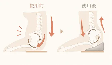 骨盤が立たない人の骨盤の図