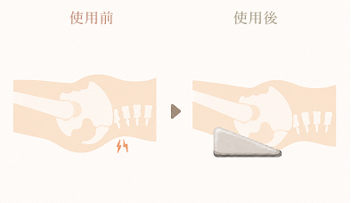 反り腰の人の骨盤の図