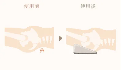 反り腰の人の骨盤の図